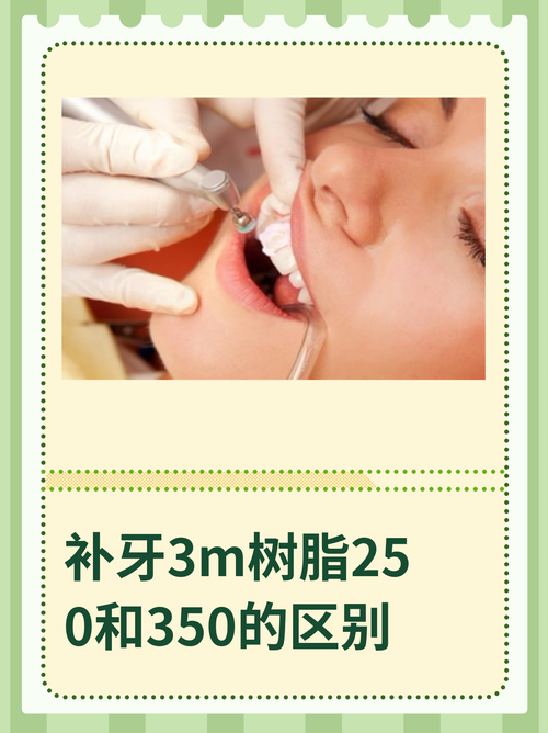 3m树脂补牙的具体操作步骤是怎样的？补后牙齿耐用性如何？日常护理有哪些注意事项？-图1