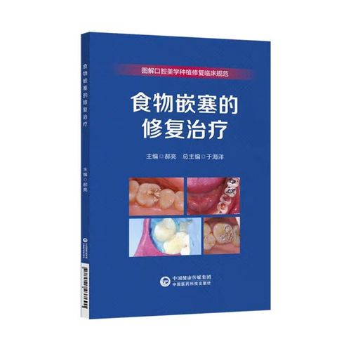 食物嵌塞后，家庭护理（如牙线、冲牙器）与专业治疗（如补牙、牙周治疗）哪种更有效？不同嵌塞程度该如何选择最佳方案？-图3