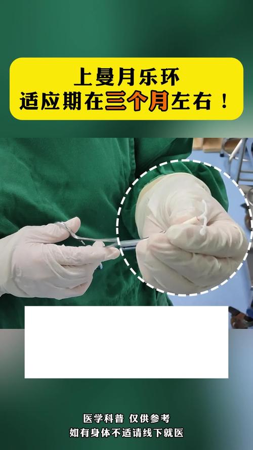 正畸上带环的详细步骤-图3