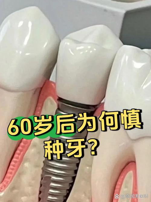 60岁种牙还值得吗?身体机能下降、手术风险、效果持久性与性价比该如何权衡?-图2 60岁种牙还值得吗?身体机能下降、手术风险、效果持久性与性价比该如何权衡?-图2