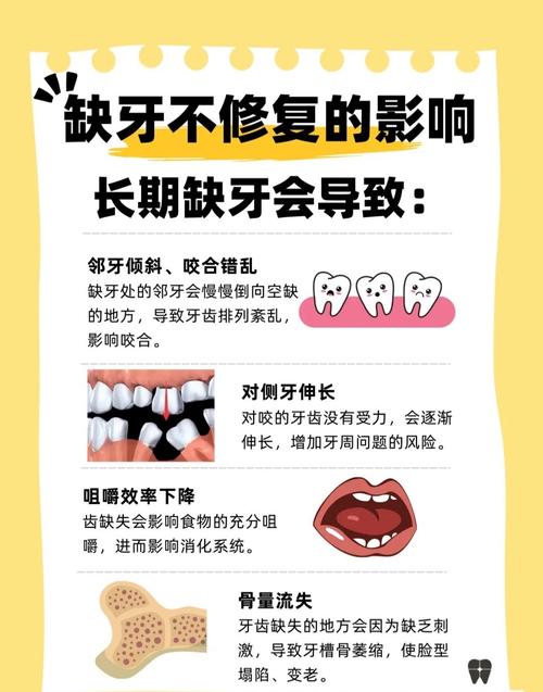 缺颗牙不种牙真的没关系吗？长期不补会对邻牙和口腔造成哪些影响，还有哪些替代修复方案？-图1