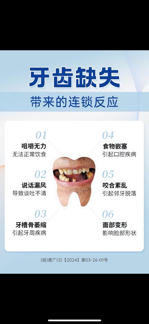 缺颗牙不种牙真的没关系吗？长期不补会对邻牙和口腔造成哪些影响，还有哪些替代修复方案？-图2