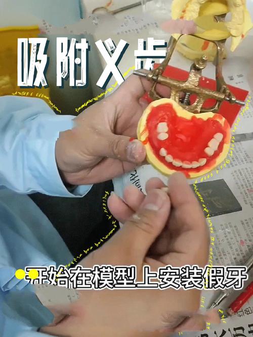 义齿隐形制作方法中，数字化扫描、3D打印及材料选择如何协同保障精准适配与隐形效果？-图1
