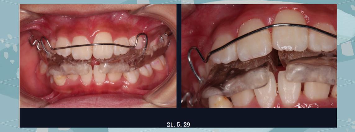 制作肌激动器的具体步骤有哪些?需要准备哪些材料和工具?过程中有哪些关键注意事项需重点关注?-图2 制作肌激动器的具体步骤有哪些?需要准备哪些材料和工具?过程中有哪些关键注意事项需重点关注?-图2