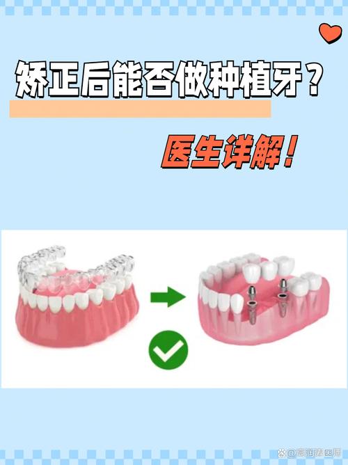 做正畸后能种牙吗-图1