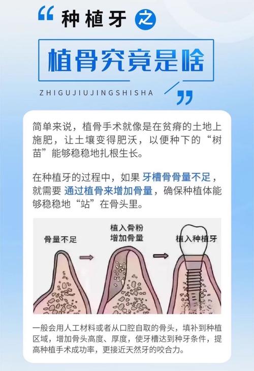 种植牙遇上骨量不足，是先打地基植骨还是直接盖房子种牙？两者的顺序到底该如何科学抉择？-图1