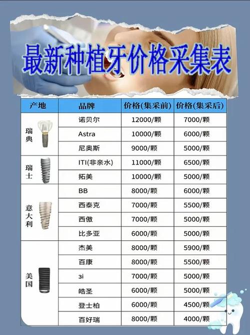 想知道在廊坊种牙大概需要多少费用吗?不同种植体品牌、牙冠材料以及医院资质的差异会导致价格有何不同?-图1 想知道在廊坊种牙大概需要多少费用吗?不同种植体品牌、牙冠材料以及医院资质的差异会导致价格有何不同?-图1