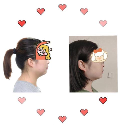 合肥牙齿正畸医院怎么选？医生资质、价格透明度、案例效果这些关键点怎么判断？-图2