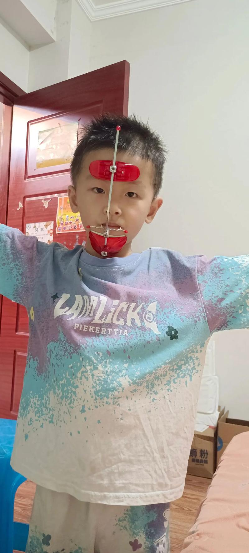 正畸中上颌尖牙向下向后牵引的原理是什么？适用于哪些错颌畸形？临床操作中如何控制牵引方向与效果？-图1