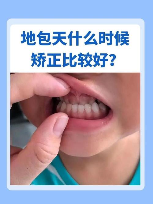 下兜齿矫正有哪些常见方法？不同年龄段如何选择合适的矫正方案？-图3