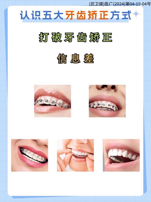 门牙开颌矫正有哪些方法？儿童和成人矫正方式有何不同？效果能维持多久？-图3