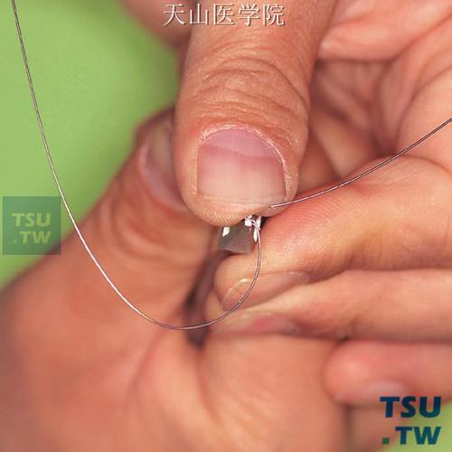 弓丝热处理方法如何通过工艺参数优化提升其力学性能与耐腐蚀性？-图2