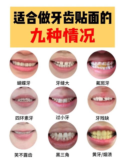 咬合紧为什么会被视为种牙的禁忌？背后存在哪些潜在风险与应对策略？-图3
