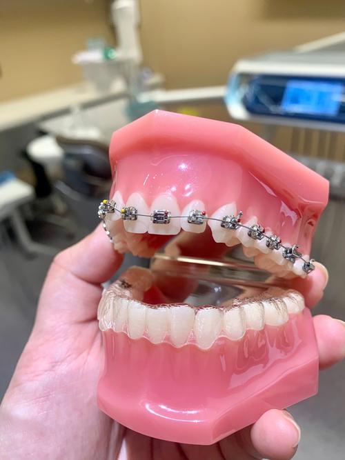 沈阳奥新全民口腔正畸效果如何？不同年龄段矫正有哪些注意事项？价格是否透明？-图2