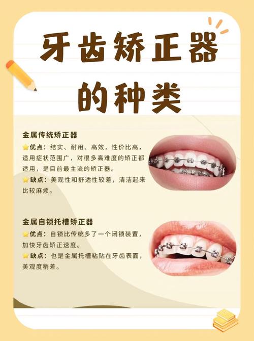 正畸自锁托槽的正确使用步骤有哪些?与传统托槽相比操作难度如何?矫正期间有哪些饮食禁忌和护理要点?-图3 正畸自锁托槽的正确使用步骤有哪些?与传统托槽相比操作难度如何?矫正期间有哪些饮食禁忌和护理要点?-图3