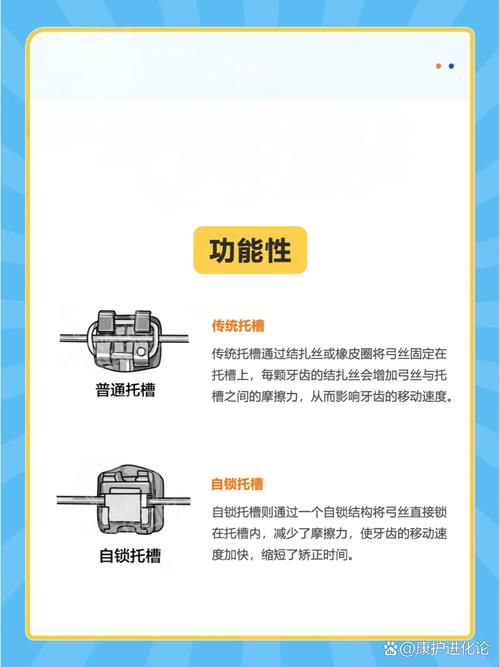 牙齿正畸时选择国产自锁托槽，其矫治效果、舒适度及长期安全性是否可靠？-图2
