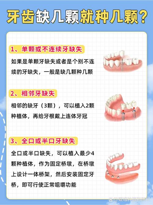 缺失三颗牙该怎么种？种植牙的具体步骤、适用条件、费用及术后护理全解析-图3