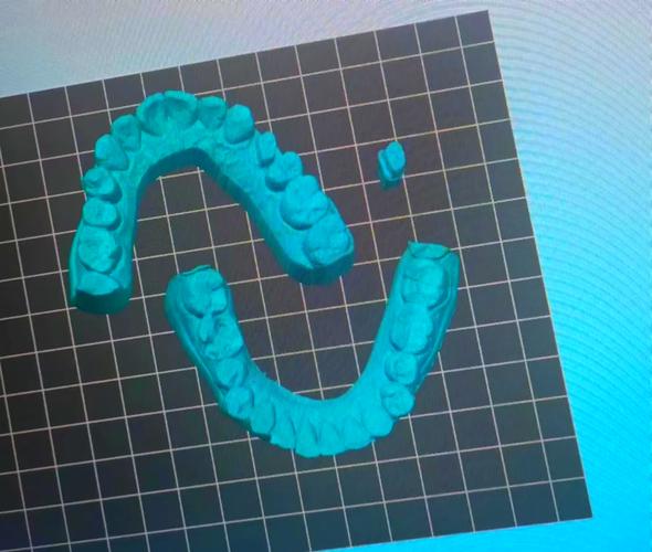 口腔数字修复方法与传统修复方法有何不同？-图1