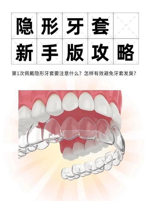 隐形牙套矫治方法有哪些？效果怎么样？-图1