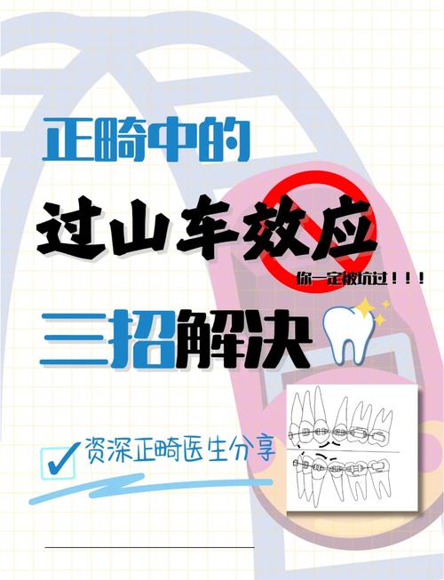 正畸过山车效应，矫正过程为何像坐过山车？-图1