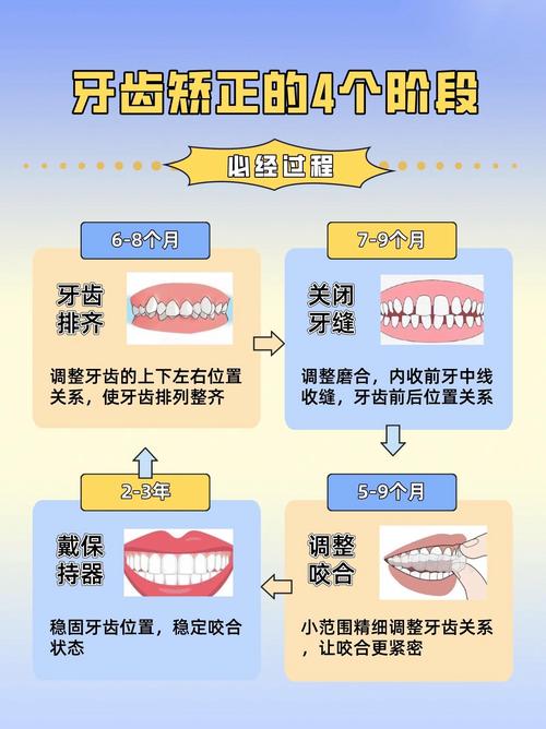 矫正牙齿的小方法有哪些实用窍门？-图3