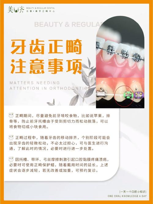 成人正畸注意事项，年龄、周期、效果如何兼顾？-图2