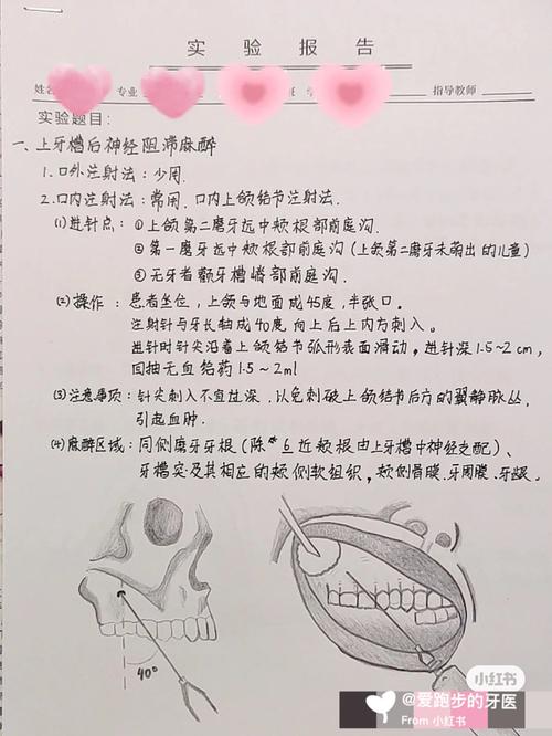 口腔各牙麻醉方法-图3