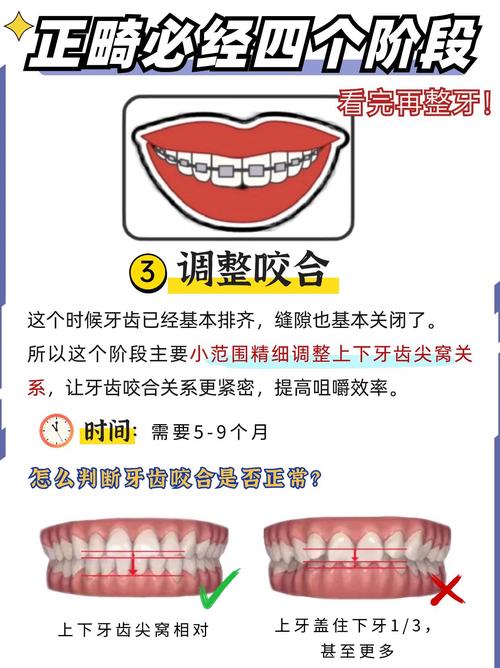 如何选择适合儿童的牙齿松动固位方法?-图2 如何选择适合儿童的牙齿松动固位方法?-图2