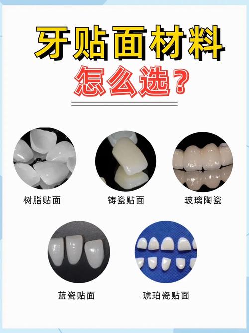 临时牙贴面的制作方法是什么？步骤有哪些？-图2