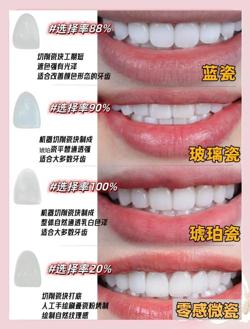 临时牙贴面的制作方法是什么？步骤有哪些？-图3