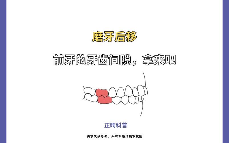 正畸后磨牙移动速度的影响因素有哪些？-图1