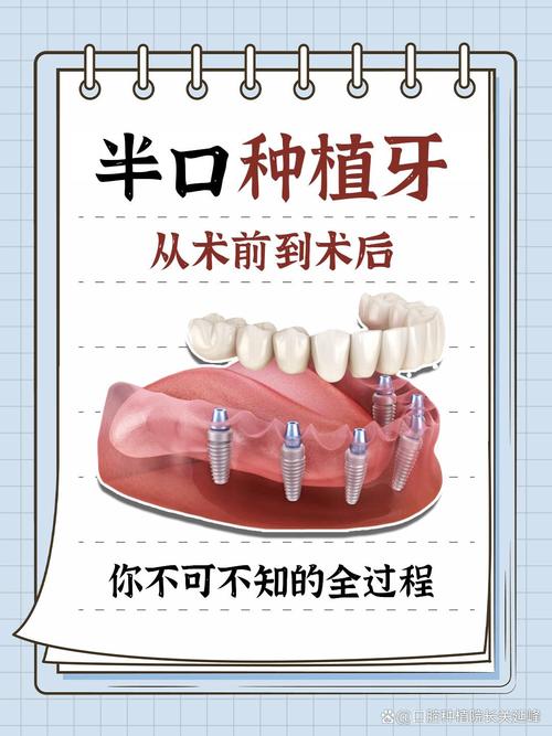 种半口牙需要住院吗？术后恢复要注意什么？-图2