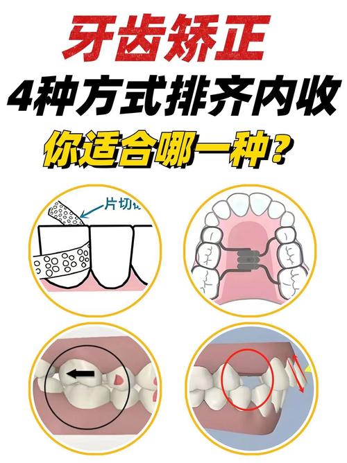 如何科学打开后牙槽？具体步骤和方法有哪些？-图3