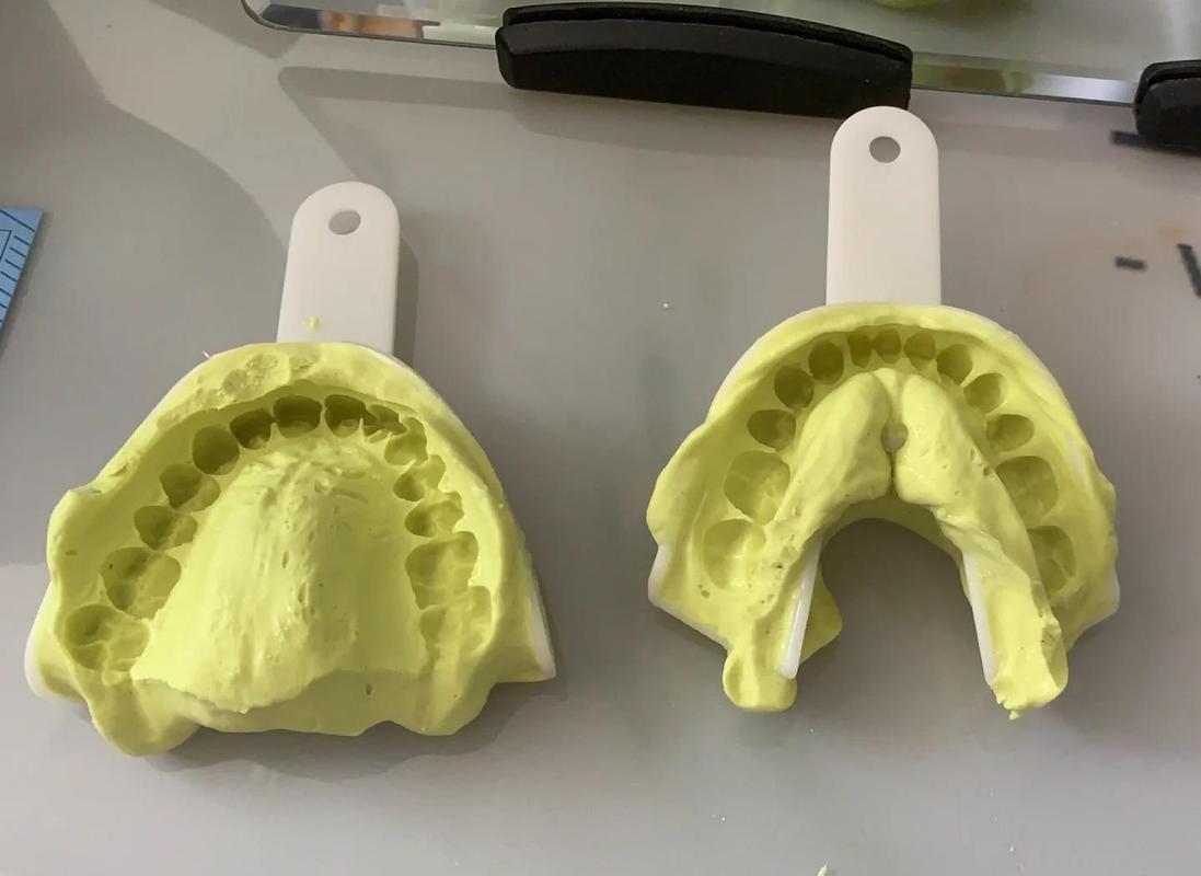 口腔硅胶取模的正确方法步骤是怎样的？-图2