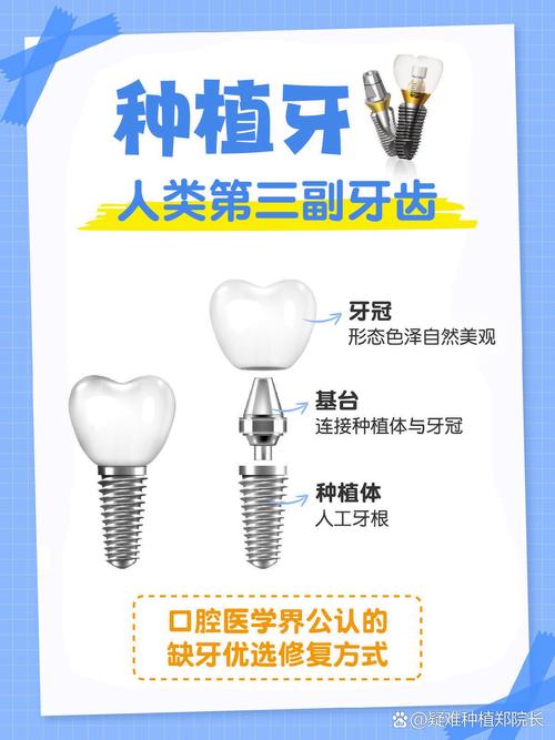 种牙后牙体具体分为哪几种不同类型呢?-图2 种牙后牙体具体分为哪几种不同类型呢?-图2