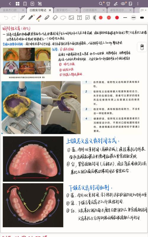 活动修复调颌的具体方法及操作步骤是什么?-图2 活动修复调颌的具体方法及操作步骤是什么?-图2