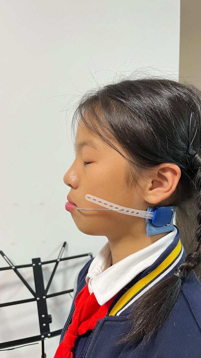 错合畸形矫治方法如何科学选择个性化方案？-图1