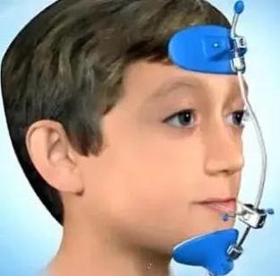 正畸反颌口外牵引装置适用于哪些反颌类型？-图2