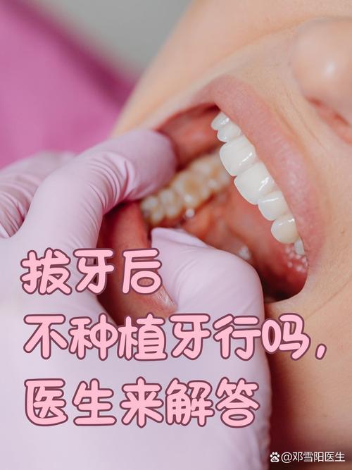 拔牙后就得种牙吗？不种会有啥问题？-图2