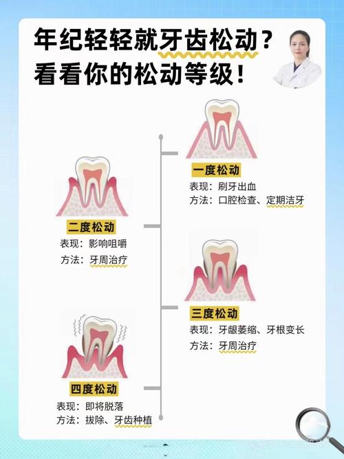 种植牙松动会掉落吗？脱落风险大吗？-图1