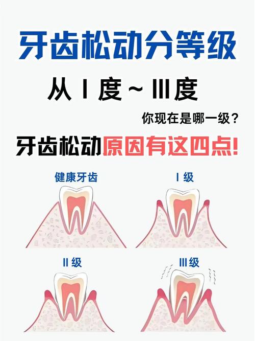 种植牙松动会掉落吗？脱落风险大吗？-图3