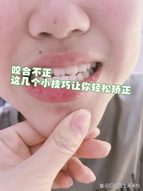 咬合矫正的最佳方法是什么？如何选择适合自己的方案？-图2