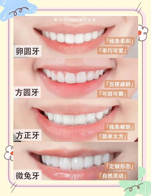 车瓷牙形态小方法如何精准塑造自然效果？-图2