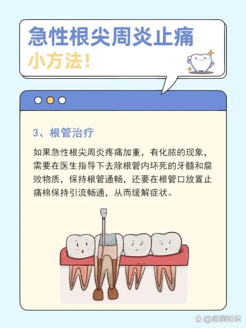 牙尖治疗方法有哪些?如何有效治疗牙尖问题?-图1 牙尖治疗方法有哪些?如何有效治疗牙尖问题?-图1