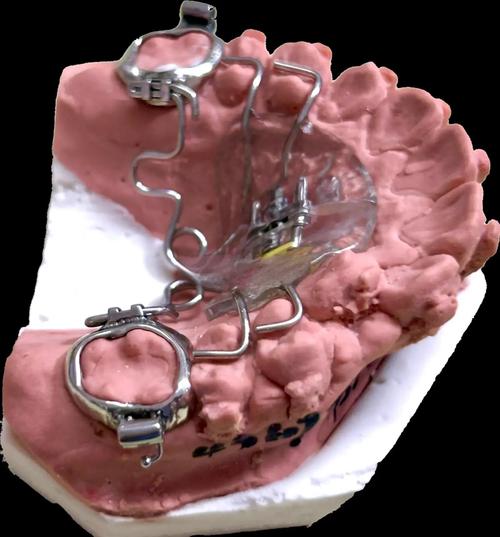 正畸自锁托槽开启工具如何正确高效操作？-图3