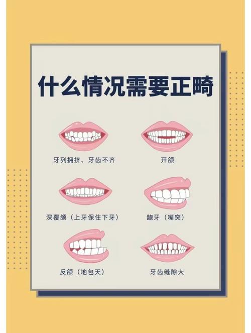 春节期间正畸科正常上班吗？接诊时间安排如何？-图2