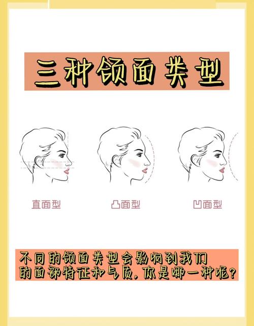 正畸侧貌面型分类标准-图1 正畸侧貌面型分类标准-图1