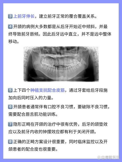 前牙开颌如何有效治疗？方法有哪些？-图2
