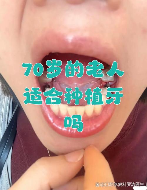 种牙后老人更幸福?种牙如何提升晚年幸福感?-图2 种牙后老人更幸福?种牙如何提升晚年幸福感?-图2