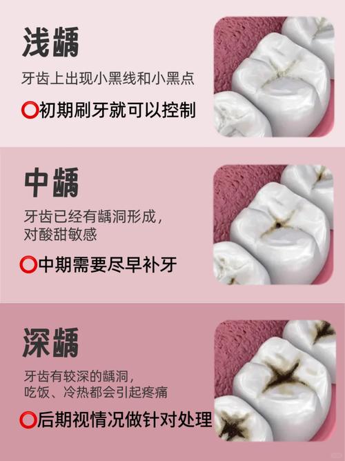 蛀牙发黑怎么办？有哪些有效的处理方法？-图1